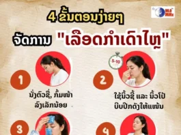 4 ຂັ້ນຕອນງ່າຍໆ ຈັດການ “ເລືອດກຳເດົາໄຫຼ” ໃຫ້ຢຸດພາຍໃນ 5 ນາທີ